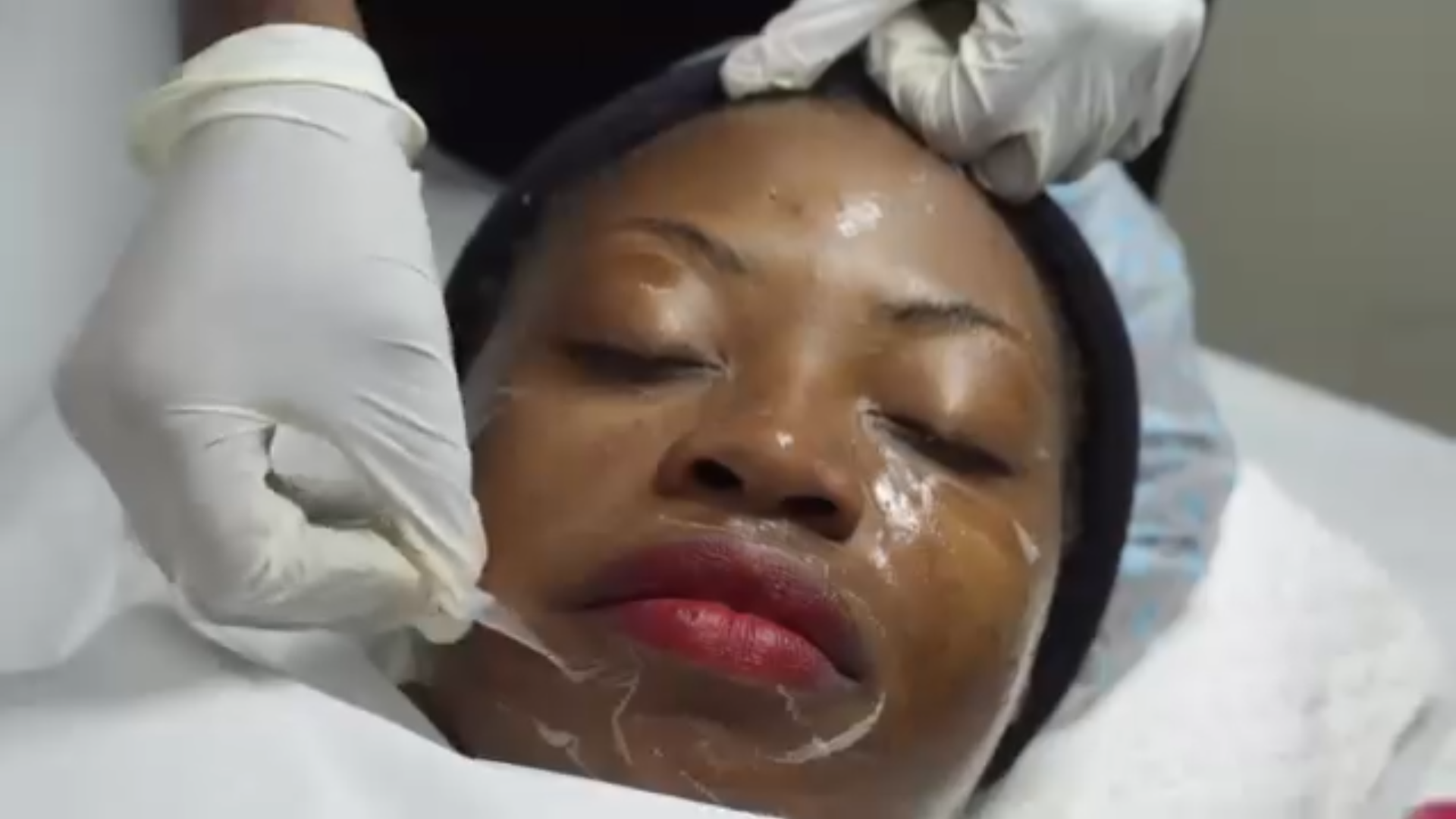 Skin Care